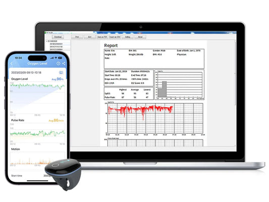 O2 Ring Pulse Oximeter with Alarm, Blood Oxygen Saturation Monitor with Bluetooth, Heart Rate Monitor, Continuously Tracking SpO2 and Heart Rate, App and PC Report, Rechargeable
