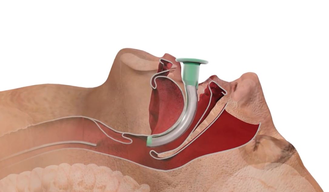 Immediate Life Support in Dental Sedation (LIDS) course from UKSedation  - 3 hours face to face ILS equivalent